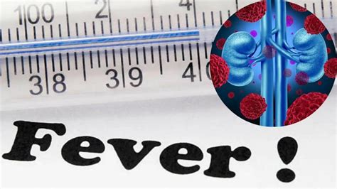 Can Fatty Liver Cause Cancer? Here's What the Experts Say