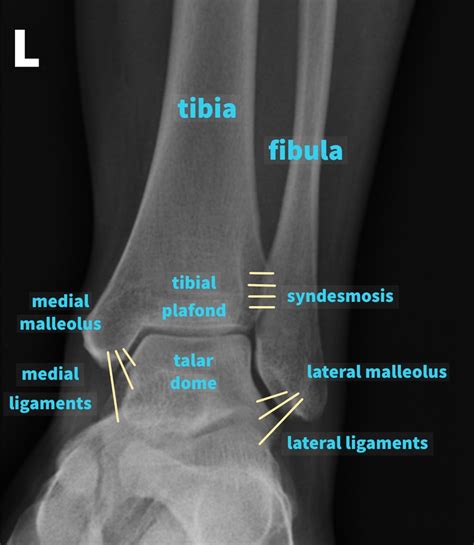 Normal Left Ankle Xray