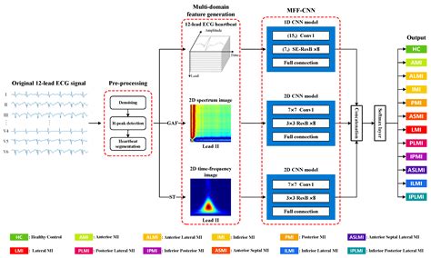 A Multi-Domain Feature Fusion CNN for Myocardial Infarction Detection ...