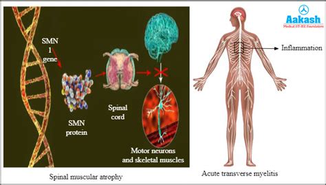 Spinal Cord: Structure, Anatomy, Functions, Injuries, Common Disorders ...