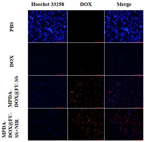 In vitro Antitumor Properties of Fucoidan-Coated, Doxorubicin-Loaded ...