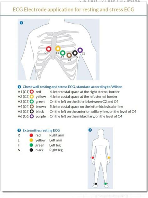 Ekg Placement