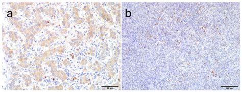 Identification of the Recently Described Avian Hepatitis E Genotype 7 ...