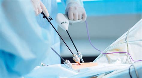 Laproscopic Surgery - Mohit Hospital