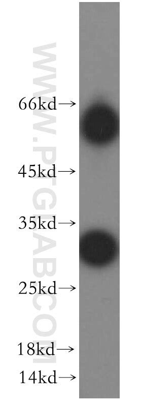 TIMP-4 antibody (12326-1-AP) | Proteintech