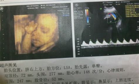 【怀孕两个月见红是什么原因】【图】怀孕两个月见红是什么原因造成 分析怀孕初期出血的原因_伊秀亲子|yxlady.com