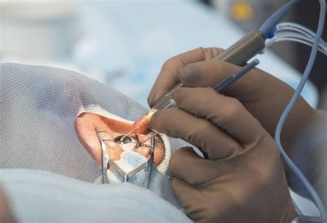 Retina Surgery In Nagpur- Dr. Pankaj Anantwar In Nagpur