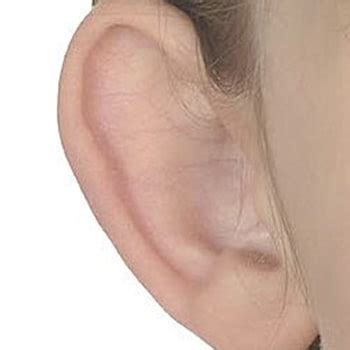 Bat ear treatment Chennai | Dr. Rohini