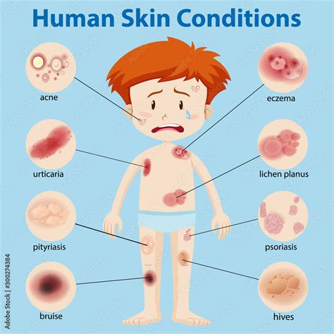 Image result for Different Types of Skin Conditions