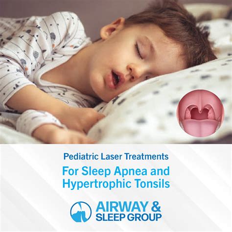 Snoring After Tonsillectomy And Adenoidectomy at Evelyn Saltsman blog