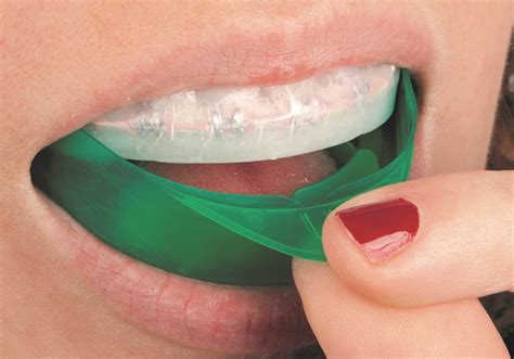 Opalescence Tooth Whitening - Optident - Specialist Dental Products And ...