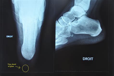 sofimofi: Congrats! You have won a getaway.... to FV Hospital!