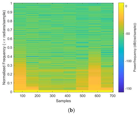 Structural Anomalies Detection from Electrocardiogram (ECG) with ...