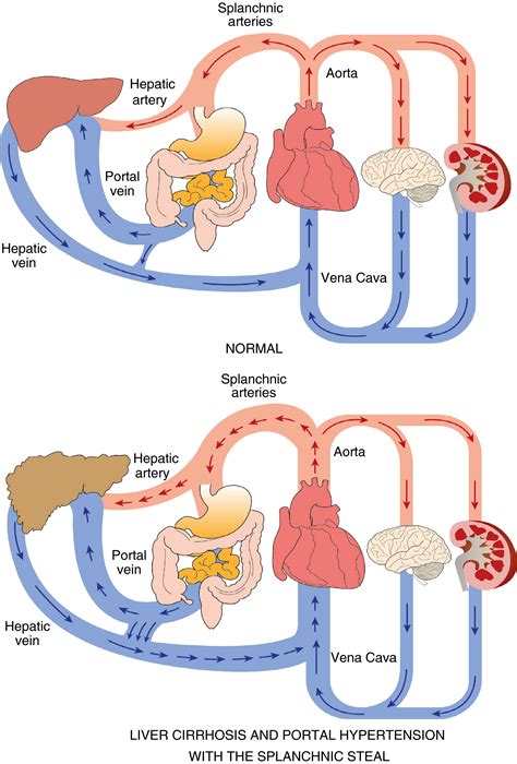 Differential visceral blood flow in the hyperdynamic circulation of ...