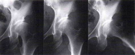 Image result for Contralateral Leg Raise