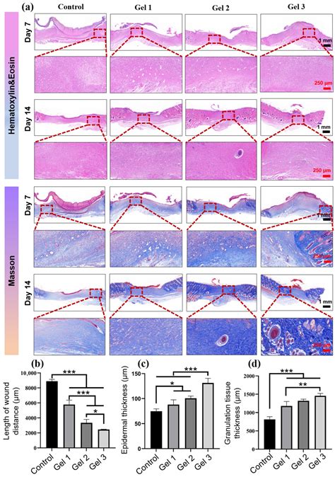 Hydroxyproline-Modified Chitosan-Based Hydrogel Dressing Incorporated ...
