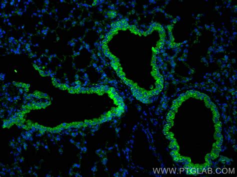 MUC5B antibody (28118-1-AP) | Proteintech