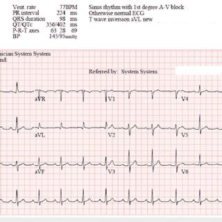Image result for Synchronized Cardioversion Machine