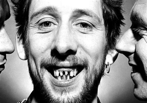 Shane Macgowan New Teeth