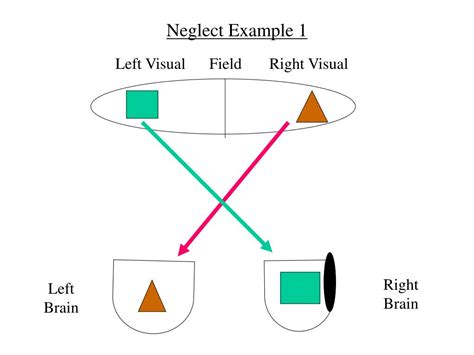 Image result for Visual Fields Red Pin