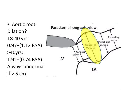 Echo assessment of Aortic Regurgitation | PPTX
