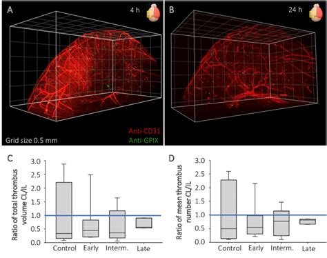 Image result for Contralateral Hemisphere