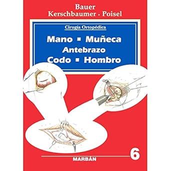 Buy Cirugia Ortopedica Mano, Muneca, Antebrazo, Codo, Hombro Vol. 6 ...