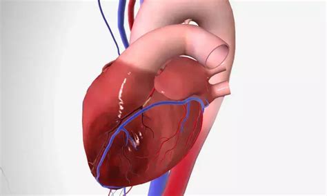 First dual chamber leadless pacemaker implanted in a child, report ...