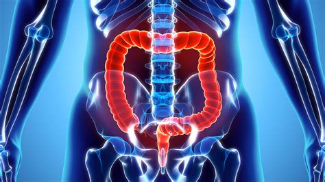 Colon-Rectum Cancer- Prognosis and Life Expectancy | Best Gastro Surgeon Ahmedabad, Best ...