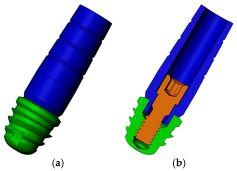 A Finite Element Analysis to Compare Stress Distribution on Extra-Short ...