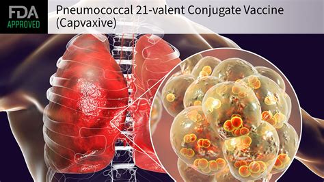 FDA Approves Pneumococcal Vax Designed Specifically for Adults ...