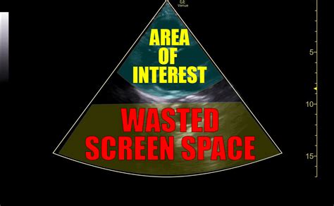 Image result for Ultrasound Scanner Depth Control