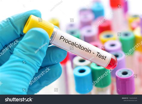 PCT Sample Test 的图像结果