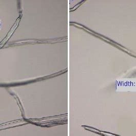 Image result for Eucalyplus Pulp