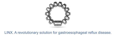 Image result for Linx Gerd Procedure