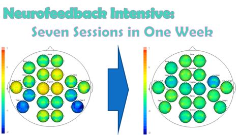 PTSD and Alpha Theta Neurofeedback Training - Neurofeedback London