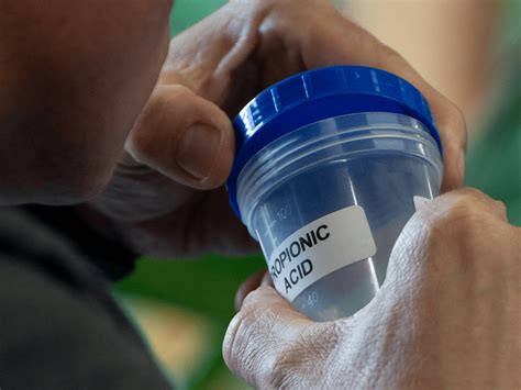 Propionzuur: de onderhouder van je huid | Esse Skincare NL