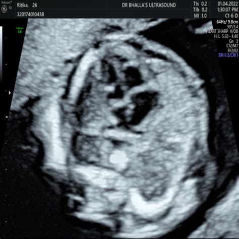 Dr. Bhalla’s Ultrasound & Imaging in Amritsar, India