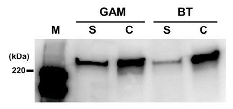 The Human Gut Microbe Bacteroides thetaiotaomicron Suppresses Toxin ...