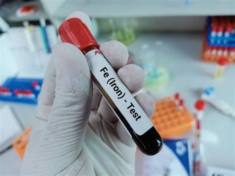 Iron Deficiency Anemia: Symptoms, Causes, and Blood Tests – MyDiagnostics