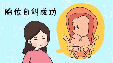 多半孕妈面临胎位不正，孕28周是临界点，孕妈要学会胎位“自纠”_小赵