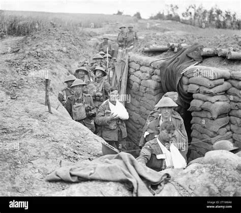 The Hundred Days Offensive, August-november 1918 Stock Photo - Alamy