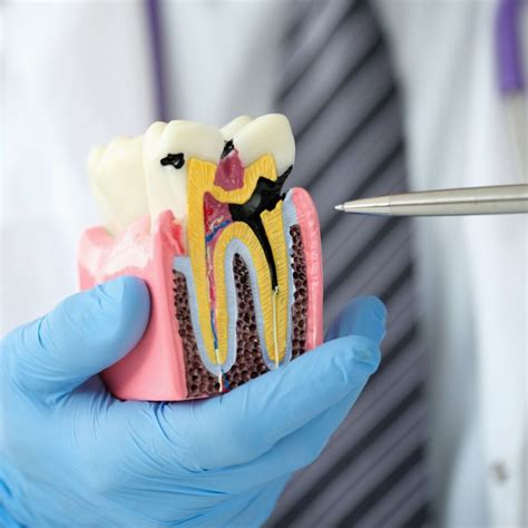 How To Tell If You Have A Cavity - Dr. Lakshmi Ramgopal