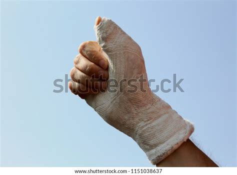 Hand Plaster 的图像结果