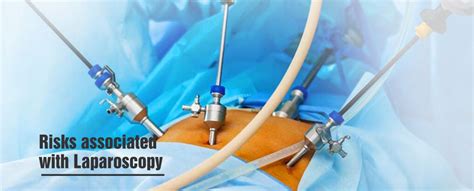 Laparoscopy: Why It’s Done, Risks, What to Expect & Treatment in ...