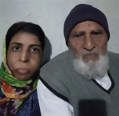 She reached Dubai to fix burnt face, got death sentence