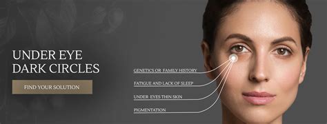 Dark Circle – GYN Wellness Pvt Ltd