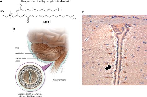 Image result for Intrathecal Injection Mouse