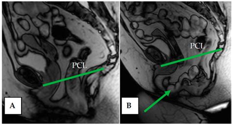 Diagnostic Value of Dynamic Magnetic Resonance Imaging (dMRI) of the ...