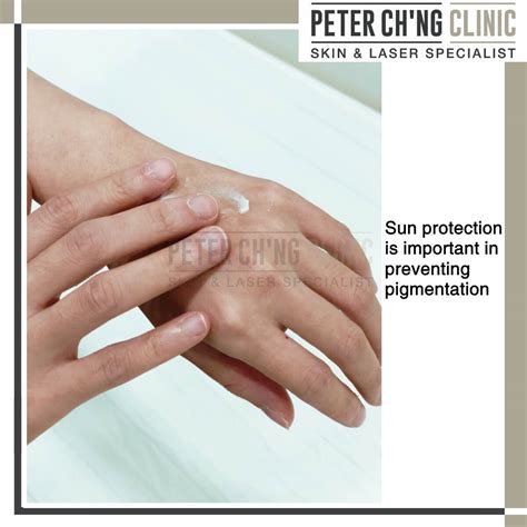 Melasma vs Hyperpigmentation | Peter Ch'ng Skin Specialist - KL, Malaysia